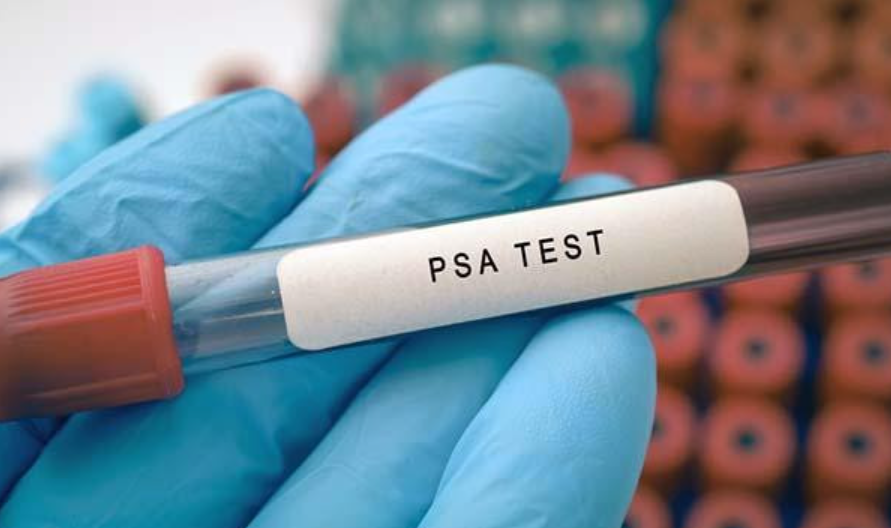 PSA TEST