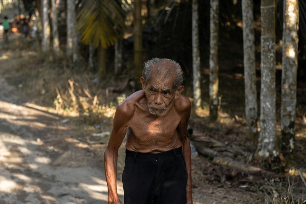 old man with athritis